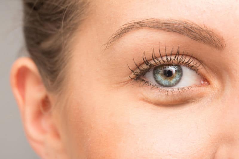 Tear Trough Fillers Gateshead