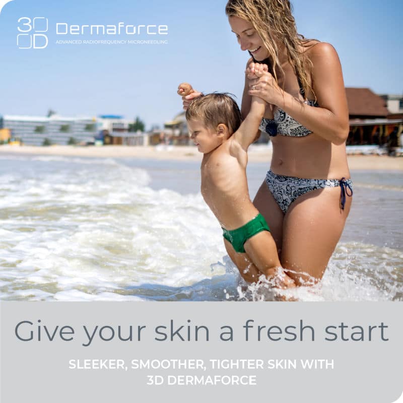 ADVANCED RADIOFREQUENCY MICRONEEDLING NEWCASTLE
