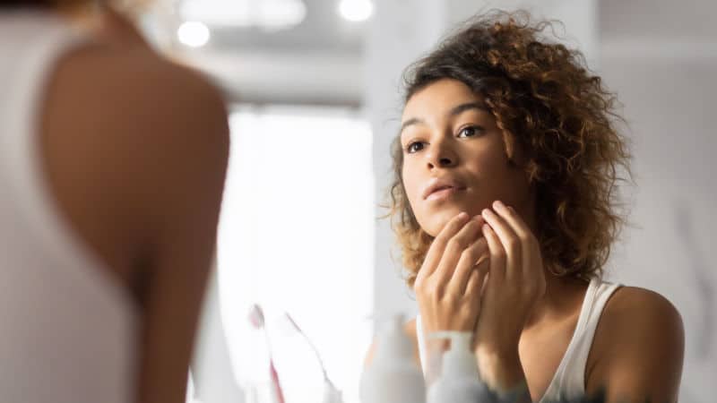 acne treatment newcastle
