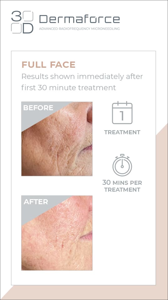 Full Face Results