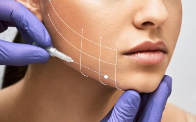 Ultimate Guide to Aptos Thread Lift