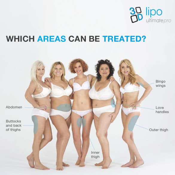 Benefits of Fat Freezing