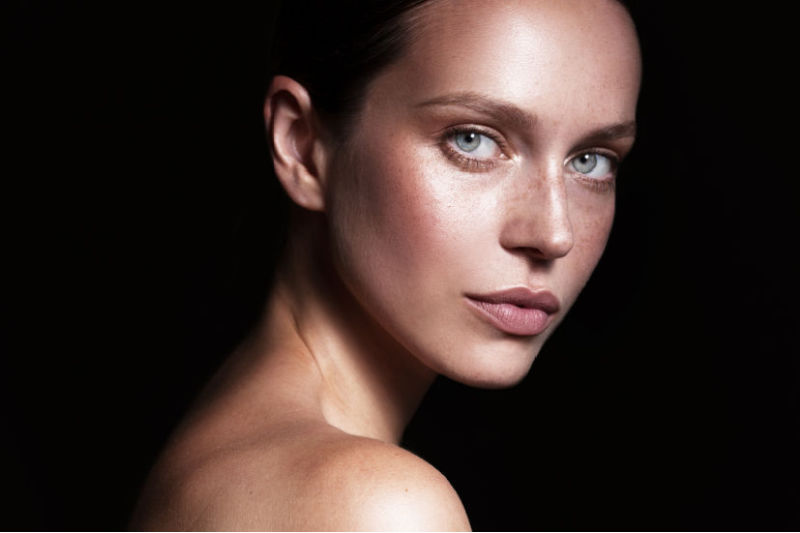 Radiesse Biostimulating Filler  Treatment with Dr Matla 